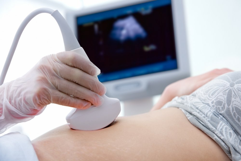 ultrasonografia-zdi-diagnosticos