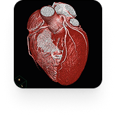 Angiotomografia coronariana