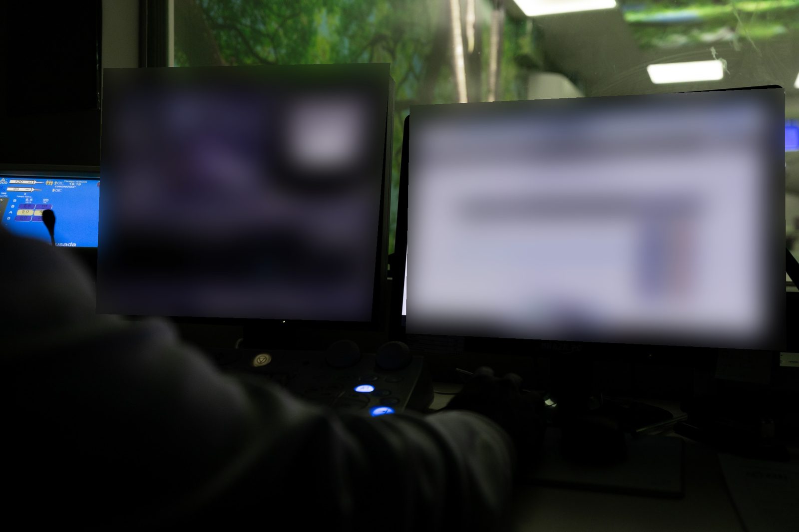 Estação de trabalho da Tomografia Computadorizada